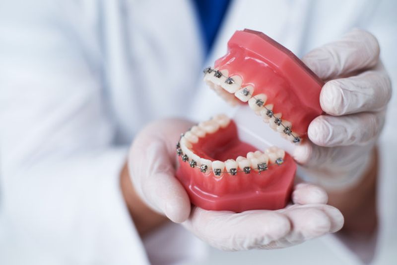 ortodontija